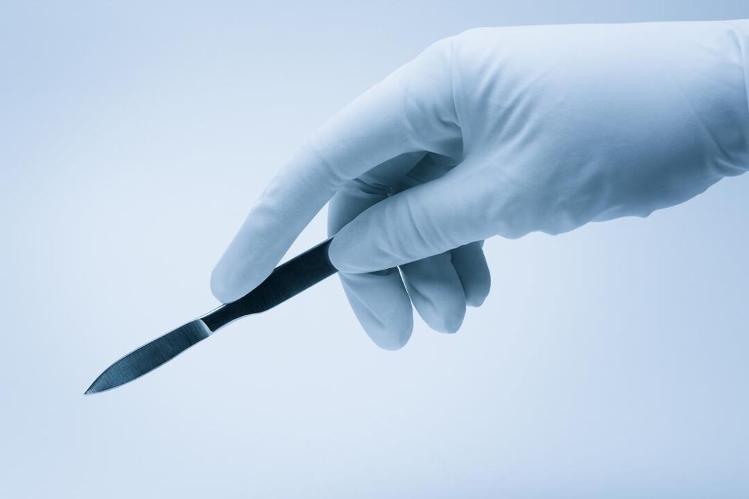 scalpel voor penisvergrotingsoperaties